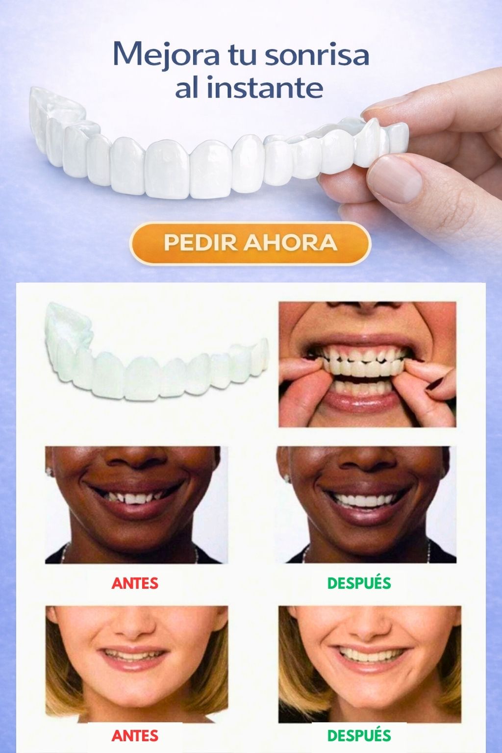 Carillas Perfect Smile®