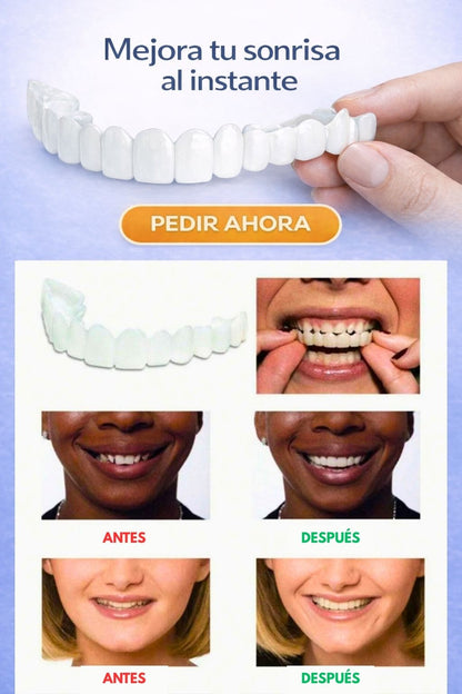 Carillas Perfect Smile®